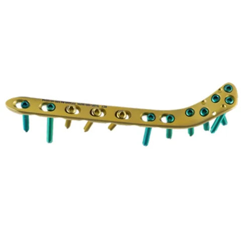 Placa-de-Bloqueo-para-Tibia-Proximal-Lateral-4.5-y-5.0-Titanio-1.webp Placa de Bloqueo para Tibia Proximal Lateral 4.5 y 5.0 Titanio