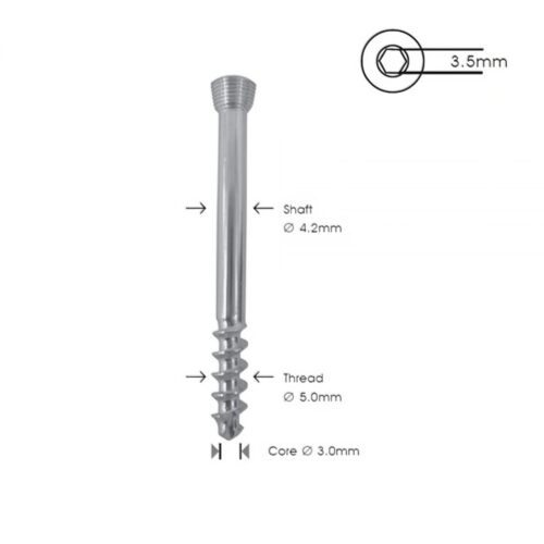 Tornillo de Bloqueo de Esponjosa 5.0 mm R-16