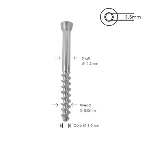 Tornillo-de-Bloqueo-de-Esponjosa-5.0-mm-R-32-01.jpeg Tornillo de Bloqueo de Esponjosa 5.0 mm R-32