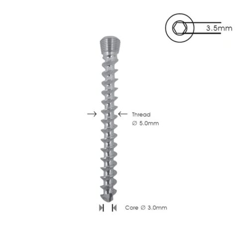 Tornillo-de-Bloqueo-de-Esponjosa-5.0-mm-TR-01.jpg Tornillo de Bloqueo de Esponjosa 5.0 mm TR